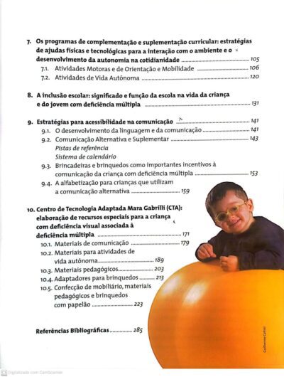 A deficiência visual associada à deficiência múltipla e o atendimento educacional especializado: encarando desafios e construindo possibilidades - Imagem 5